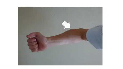 white arrow indicats a position where many grasping muscles inside